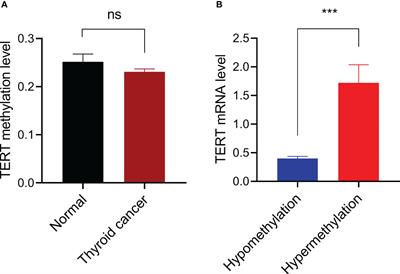 TERT promoter methylation is associated with high expression of TERT and poor prognosis in papillary thyroid cancer